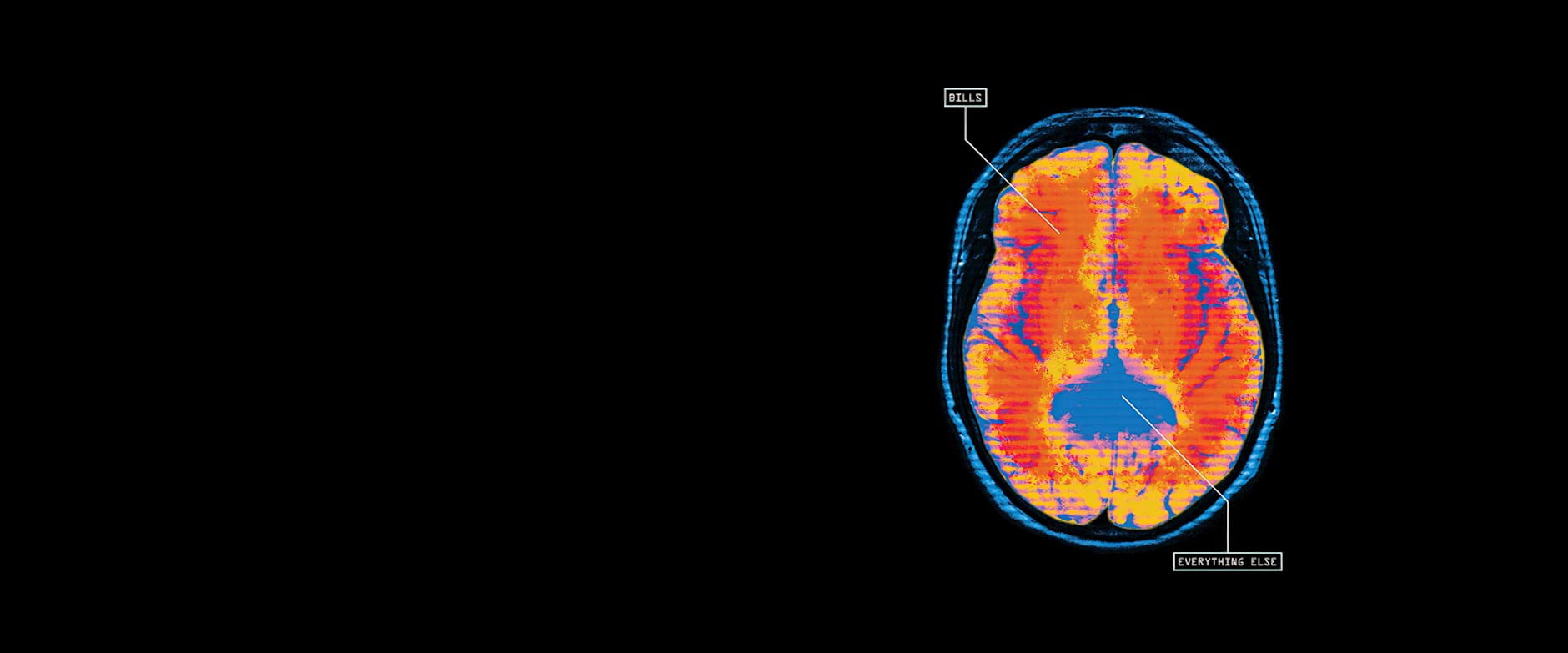 Primary colored brain scan